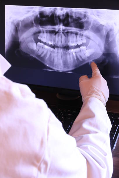 Best Emergency Dentist for Knocked-Out Tooth in Mack, OH