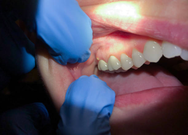 Best Broken or Cracked Tooth Emergency Dentist in Mack, OH
