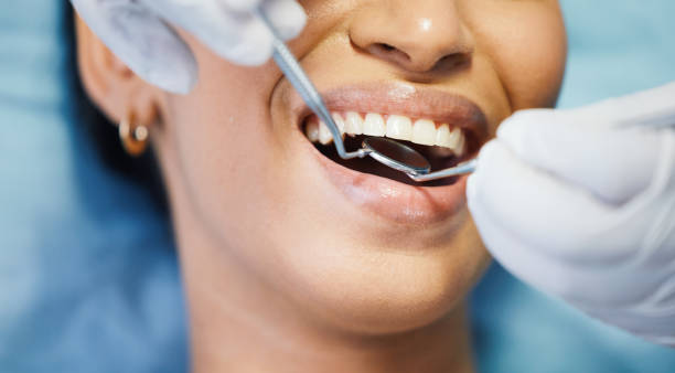 Best Emergency Dentist for Lost Fillings or Crowns in Mack, OH